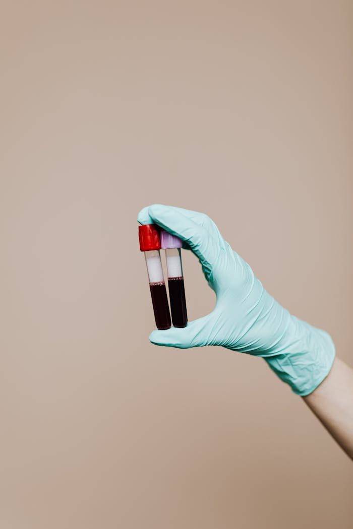 Close-up of a gloved hand holding test tubes with blood samples against a neutral background.